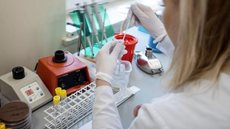 Casos confirmados de coronavírus na Rússia chegam a mais de 1.000