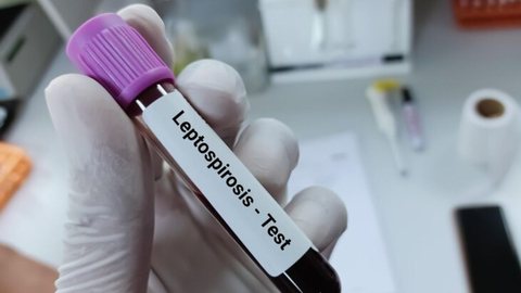 Amostra de sangue para teste de leptospirose - Imagem: Reprodução / Freepik