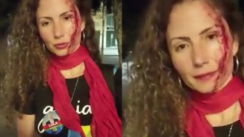 A jornalista da CNN Magalea Mazziotti foi agredida por andar com um adesivo a favor do candidato Luiz Inácio da Silva. - Imagem: reprodução I Instagram @metropoles e Site Contigo!
