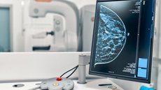 Novas regras para mamografias visam prevenção do câncer de mama - Imagem: Reprodução/Redes Sociais