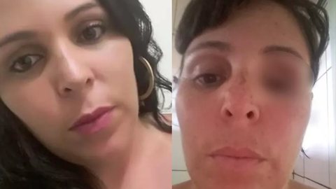 Marília de Oliveira Santos foi atacada pelo ex-marido em dezembro de 2019 - Imagem: reprodução/TV Globo