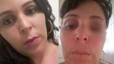 Marília de Oliveira Santos foi atacada pelo ex-marido em dezembro de 2019 - Imagem: reprodução/TV Globo