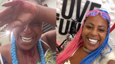 Cantora mostrou ferimentos na cabeça e disse que precisou levar pontos - Imagem: Reprodução | Redes Sociais