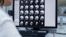 Medicamento oral para tratar tumores cerebrais é aprovado pela Anvisa - Imagem: Reprodução / Freepik