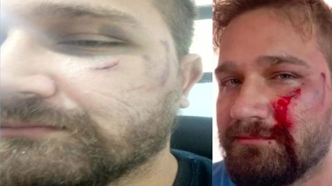 Médico é agredido com capacete após negar pedido antiético - Imagem: reprodução TV Globo