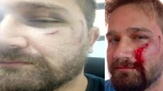 Médico é agredido com capacete após negar pedido antiético - Imagem: reprodução TV Globo