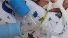 Criança tinha sido declarada morta por afogamento - Imagem: Reprodução / Correio 24 Horas