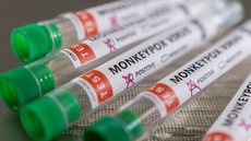 Ministro diz que Brasil terá antiviral para tratar varíola dos macacos - Imagem: Reprodução | ABr via Grupo Bom Dia