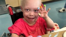Morre aos 10 anos Bella Brave, tiktoker com doença rara - Imagem: Reprodução/Tiktok