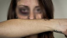 Uma mulher foi agredida por um pedaço de madeira pelo companheiro. - Imagem: reprodução I Freepik