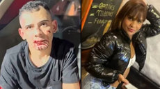Suspeito nega relação com Tainara durante prisão; jovem teve as pernas amputadas - Imagem: Reprodução | Redes Sociais