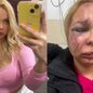 Larissa busca apoio psicológico após o trauma e teme usar o metrô novamente devido à insegurança - Imagem: Reprodução