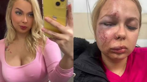 Larissa busca apoio psicológico após o trauma e teme usar o metrô novamente devido à insegurança - Imagem: Reprodução