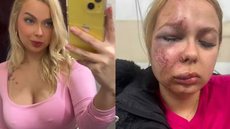 Larissa busca apoio psicológico após o trauma e teme usar o metrô novamente devido à insegurança - Imagem: Reprodução
