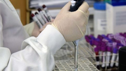 Autoridades de saúde aguardam resultados de exames complementares para confirmar ou descartar infecção pelo vírus Ebola no paciente - Imagem: Reprodução/Antonio Americo/Sesa