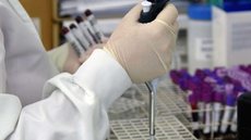 Autoridades de saúde aguardam resultados de exames complementares para confirmar ou descartar infecção pelo vírus Ebola no paciente - Imagem: Reprodução/Antonio Americo/Sesa