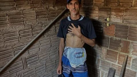 Alexandre, de 40 anos, recebe 20 bolsas a cada 2 meses - Imagem: reprodução Pedro Trindade/Inter TV Cabugi