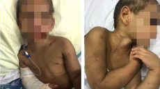 Padrasto que ajudou mãe a espancar filho de quatro anos é morto em SP - Imagem: reprodução g1