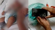 O próprio pai arremessou o celular, atingiu e matou a criança - Imagem: reprodução I G1, UOL