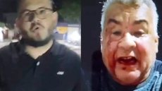 Pastor discute no trânsito e quebra nariz de idoso - Imagem: Reprodução/Fuxico Gospel