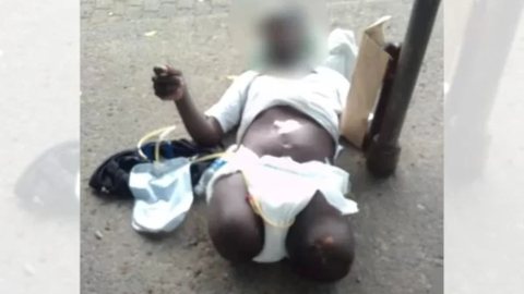 Homem com as pernas amputadas é abandonado em frente ao hospital em estado absurdo - Imagem: reprodução