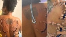 VÍDEO - mulher faz procedimento para ter borboleta nas costas e choca web - Imagem: reprodução TikTok