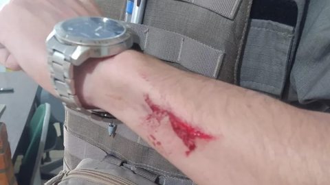 Policial Militar foi ferido no braço com golpe de faca por eleitor - Divulgação/Policial Militar