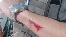 Policial Militar foi ferido no braço com golpe de faca por eleitor - Divulgação/Policial Militar