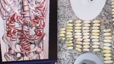 Polícia Federal prende casal em aeroporto com 2,6 quilos de cocaína no estômago - Imagem: Divulgação/ Polícia Federal