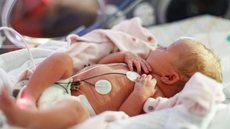 A prematuridade é uma das principais causas de mortalidade neonatal, mas pode ser prevenida com um pré-natal adequado e atenção integral - Imagem: Reprodução | Freepik