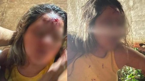 Sertanejo famoso é preso após bater cabeça da namorada na parede inúmeras vezes - Imagem: Reprodução/Metrópoles
