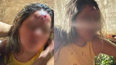 Sertanejo famoso é preso após bater cabeça da namorada na parede inúmeras vezes - Imagem: Reprodução/Metrópoles