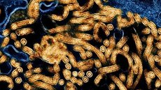 Os principais sintomas do Ebola incluem febre alta, dores musculares e manifestações hemorrágicas em casos graves - Imagem: Reprodução/DW