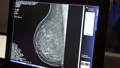 Ainda em fase de protótipo, a tecnologia promete ser uma alternativa menos dolorosa - Imagem: Divulgação