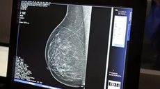 Ainda em fase de protótipo, a tecnologia promete ser uma alternativa menos dolorosa - Imagem: Divulgação