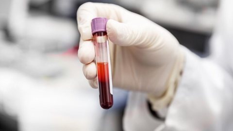 Teste de DNA pode substituir o papanicolau no futuro - Imagem: Reprodução / Freepik