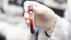 Teste de DNA pode substituir o papanicolau no futuro - Imagem: Reprodução / Freepik
