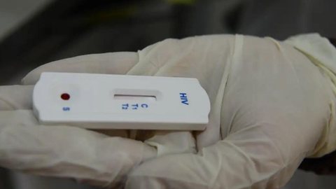 Testes rápidos para diagnóstico de HIV, sífilis, hepatites virais e outras infecções sexualmente transmissíveis (ISTs) - Imagem: Reprodução/Rovena Rosa/Agência Brasil