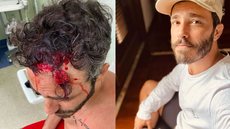 Thiago Rodrigues é espancado e passa a noite em banco de praça; entenda - Imagem: reprodução / Instagram @euthiagorodrigues