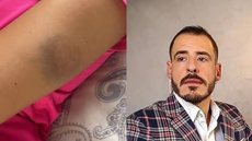 Thiago Schutz nega as acusações, alegando que foi agredido pela namorada antes de se defender, mas a Justiça o liberou sob restrições - Imagem: Reprodução - Imagem: Divulgação / Instagram