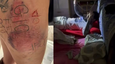 Vítima teve siglas e datas tatuadas sem consentimento durante sessão de violência - Imagem: Reprodução | Polícia Civil