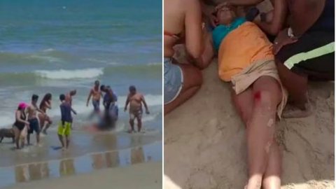 VÍDEO - em 24h, tubarão arranca braço de outro jovem no mesmo lugar - Imagem: reprodução redes sociais
