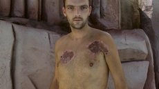Martin Richardson foi atacado durante uma viagem ao Egito - Imagem: reprodução/National Geographic