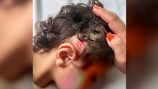 Ventilador despenca em creche deixa criança ferida - Imagem: reprodução TV Globo
