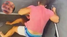 Mulher deve passar por cirurgia nos próximos dias - Imagem: Reprodução / Redes Sociais / Câmera de Segurança