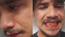 O caso foi registrado como dano ao patrimônio público e lesão corporal, levantando questões sobre racismo nas abordagens - Imagem: Reprodução / Arquivo Pessoal / G1