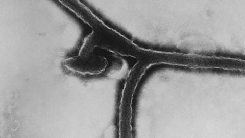 Imagem de detalhe do vírus de Marburg - Imagem: Arquivo/Dr. Fredrick Murphy/Sylvia Whitfield/CDC