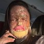Morre Karine Felipe, influenciadora que lutava contra doença rara - Imagem: Reprodução/Instagram