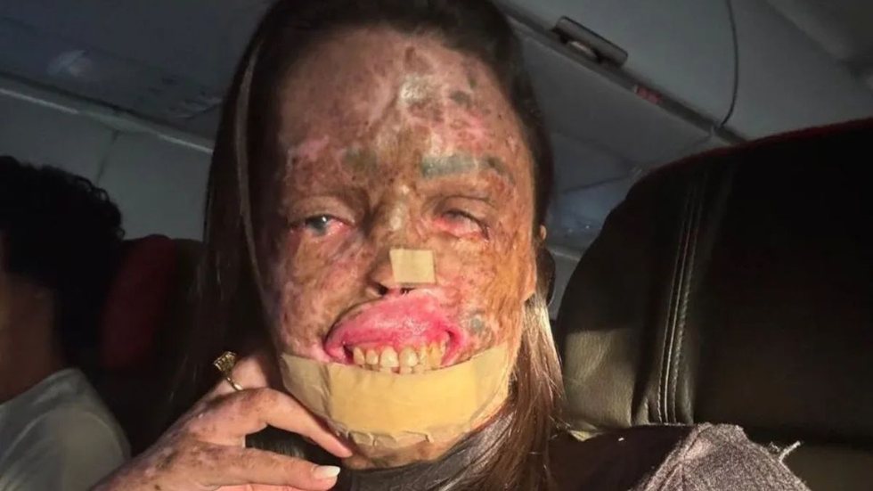 Morre Karine Felipe, influenciadora que lutava contra doença rara