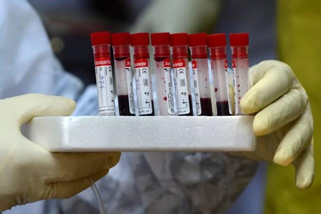 Tubos guardam amostras de sangue para testes de Covid-19, doença provocada pelo novo coronavírus, em Colombo, capital do Sri Lanka, na segunda-feira (4)  — Foto: Lakruwan Wanniarachchi / AFP